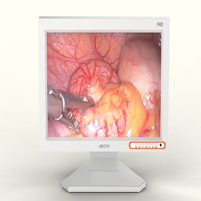 醫(yī)用灰階顯示器用過(guò)的評(píng)價(jià)如何